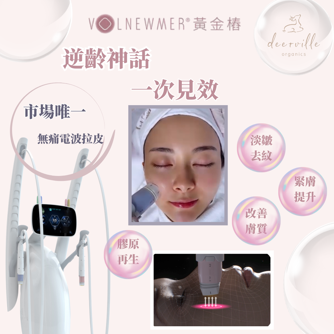 Volnewmer黃金樁
